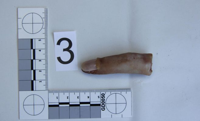 Прохожий нашёл «палец в пакетике», случай оказался неудачной шуткой