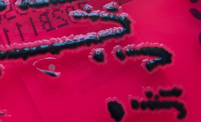 Редкая бактерия сальмонеллы обнаружена в Чехии