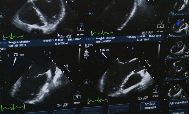 Сказки и симуляция ходьбы спасли жизнь ребенку