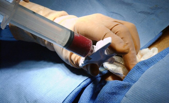 Институт клинической и экспериментальной медицины IKEM проводит набор доноров