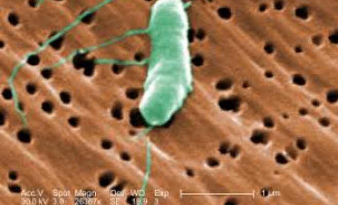 Врачам удалось спасти ногу мужчине, заразившемуся опасной бактерией в море Болгарии