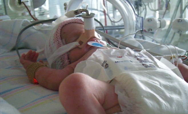 Жизни недоношенных детей спасает имитация матки