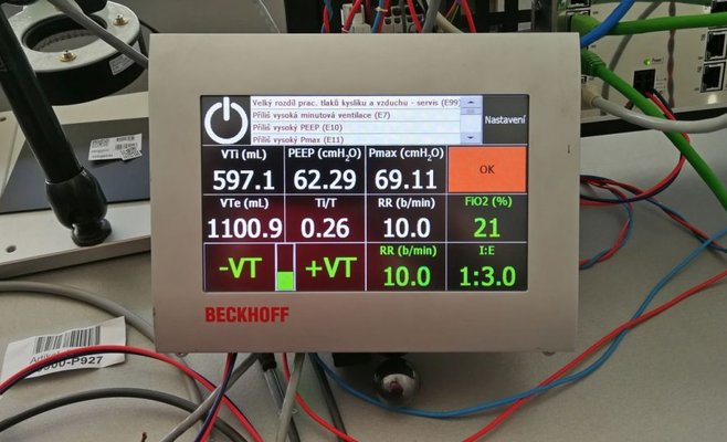 В Чехии разработали свой аппарат ИВЛ для спасения пациентов с коронавирусом