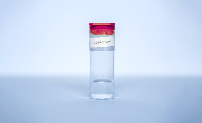 Чехия планируют перейти к методу переливания крови переболевших коронавирусом новым больным