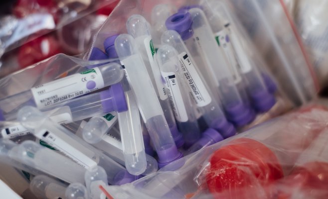 В Чехии протестируют 17 тыс. граждан на коронавирус, чтобы выяснить какой процент бессимптомно перенес заболевание