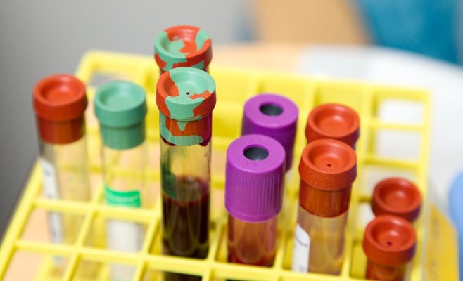 В Томайеровой больнце в Праге лечат больных COVID-19 плазмой вылечившихся