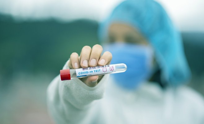 Сколько должен стоить тест на коронавирус — 500 или 3000 крон? Правительство займется этим вопросом