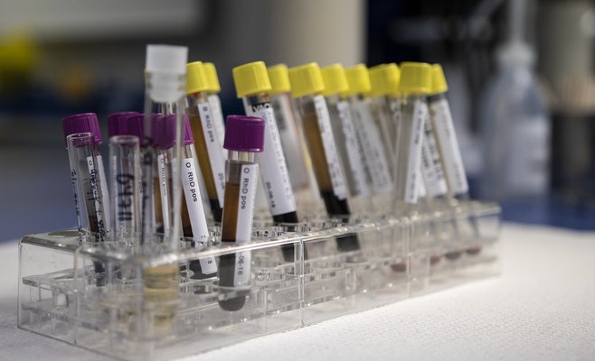 В воскресенье в Чехии было выявлено 75 новых случаев Covid-19. Это самый низкий прирост за последние две недели