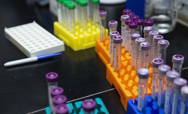 В среду в Чехии было выявлено более ста новых случаев Covid-19