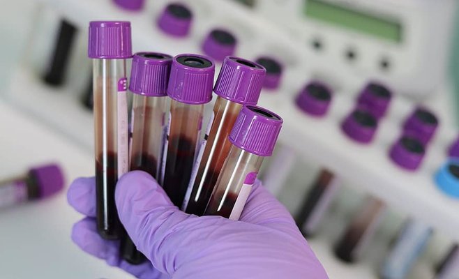 Количество новых случаев заболевания Covid-19 в Чешской Республике остается выше ста уже третий день