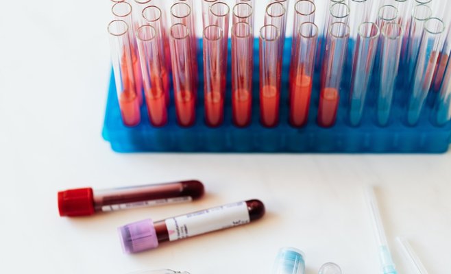 В среду прирост новых случаев Covid-19 был самым высоким за последние пять дней