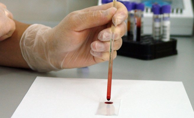 В Праге зарегистрирован рекордный прирост новых случаев Covid-19 с начала эпидемии