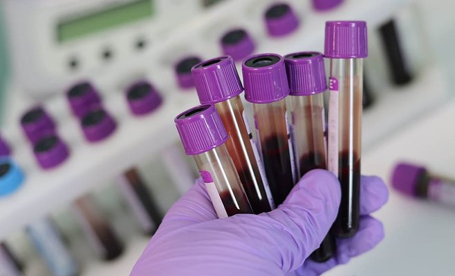 Количество новых случаев заболевания Covid-19 в ЧР побило все рекорды