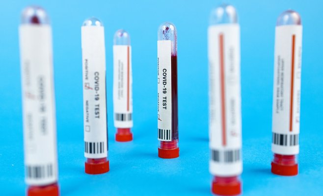 Оценка PES в Чехии выросла до 69 баллов