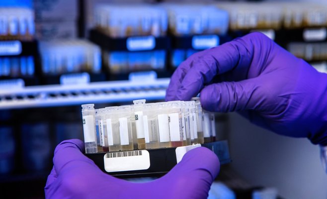 Число случаев заражения коронавирусом в Чехии за всю эпидемию превысило миллион