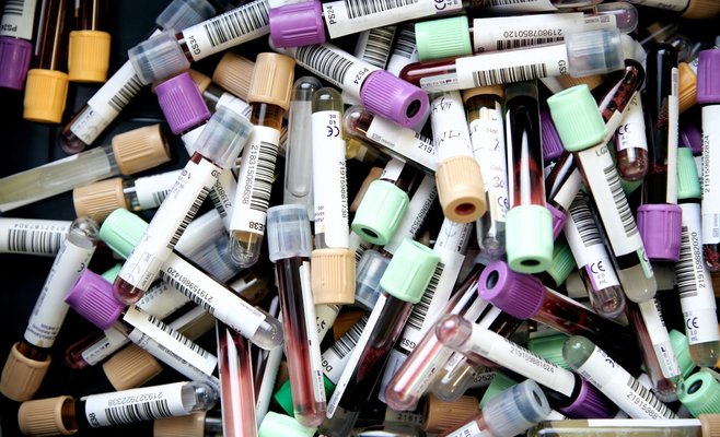 Во вторник в Чехии было зарегистрировано почти 16 тыс. новых случаев Covid-19