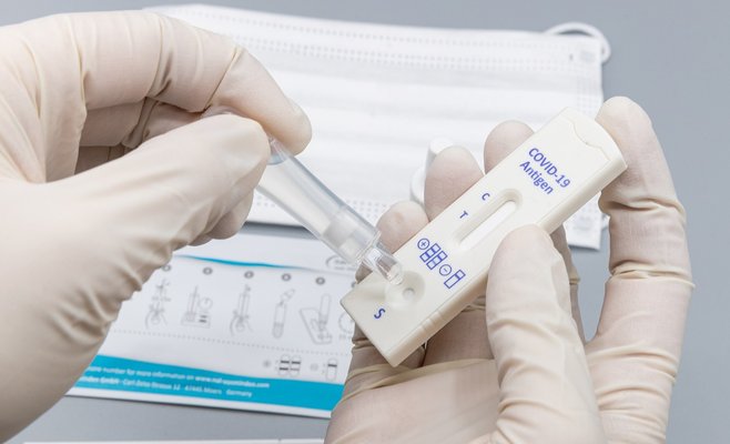 В воскресенье в ЧР было выявлено наименьшее число новых случаев Covid-19 с конца августа