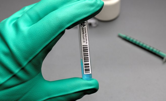 В воскресенье в ЧР было выявлено 90 новых случаев Covid-19