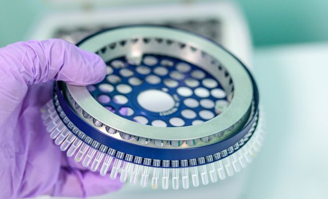 В среду в Чехии выявлено вдвое больше инфицированных, чем неделю назад