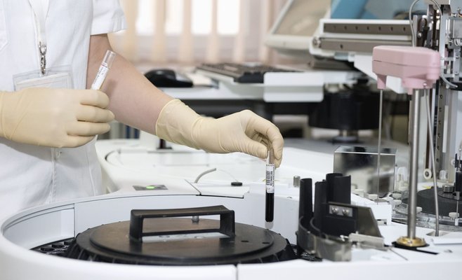 Во вторник в Чехии было выявлено более 300 инфицированных, репродуктивное число снова растет