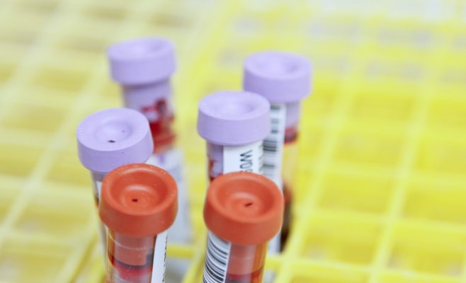 В Чешской Республике 90% образцов коронавируса подозреваются на наличие «дельта»-варианта