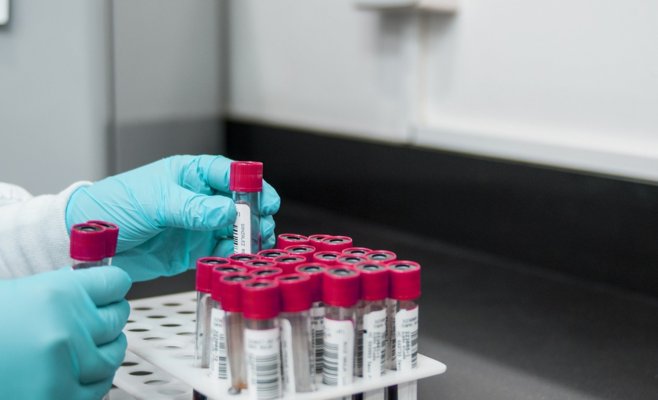 Эпидемия коронавируса в ЧР снова ускоряется