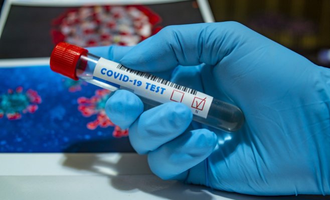 С сентября бесплатные тесты на коронавирус будут доступны только для несовершеннолетних