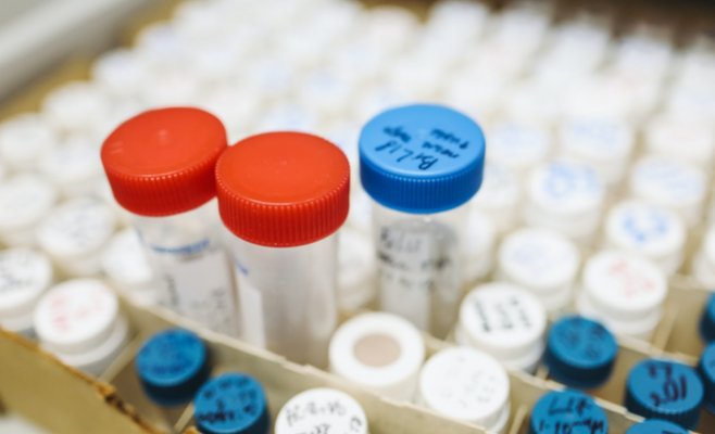 В августе в Чехии было меньше случаев заражения коронавирусом, чем в июле, но больше смертей