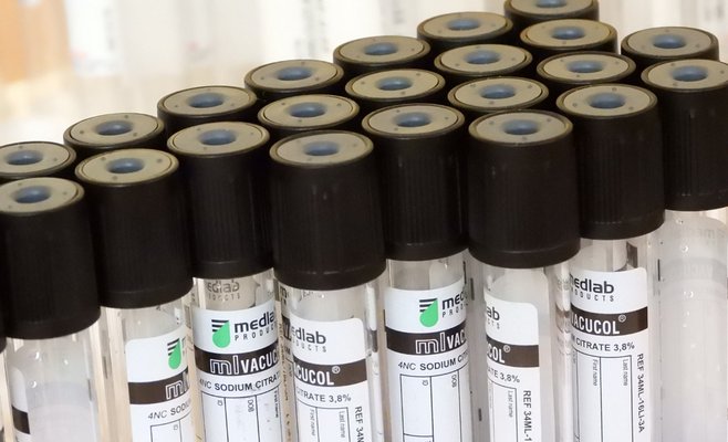 Эпидемия в Чехии продолжает усиливаться: во вторник было выявлено 588 случаев коронавируса