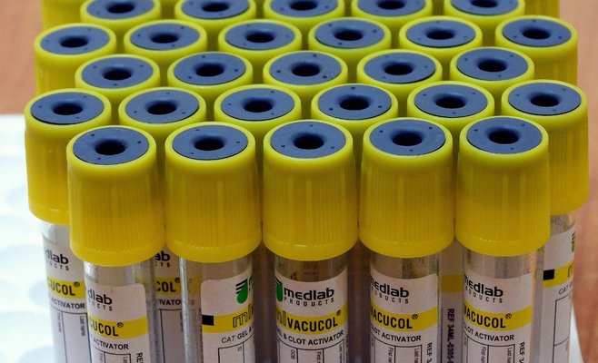 В Чехии число инфицированных коронавирусом растет с каждой неделей