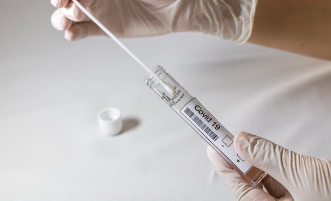 Ежедневный прирост новых инфицированных в ЧР превысил 14 тыс.