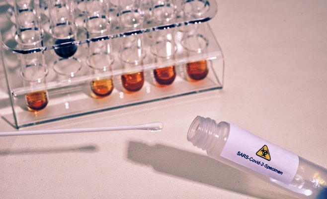 Ежедневный прирост новых случаев коронавируса в ЧР снизился до уровня конца октября