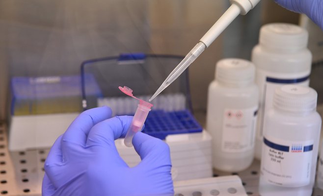 Число новых случаев Covid-19 в Чехии сократилось за неделю на 10 тыс.