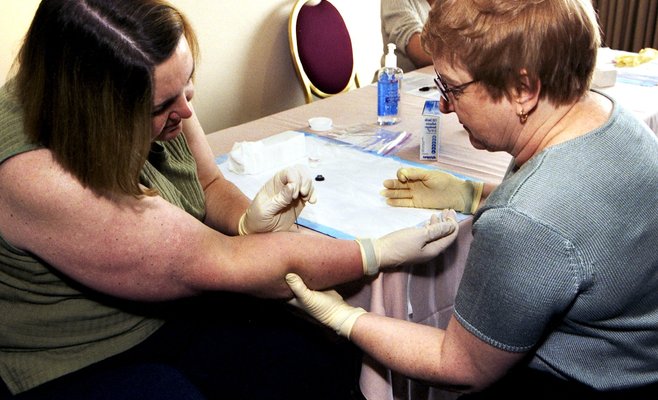 Эксперты предупреждают о возможности появления в Чехии случаев обезьяньей оспы