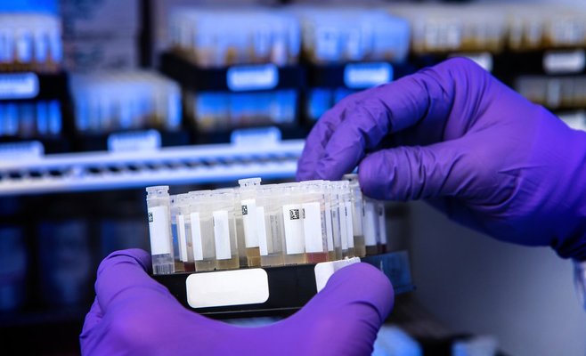 В Чехии зафиксирован девятый случай обезьяньей оспы