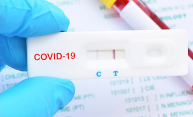 С завтрашнего дня с Ковидом можно будет ходить на работу и в школу