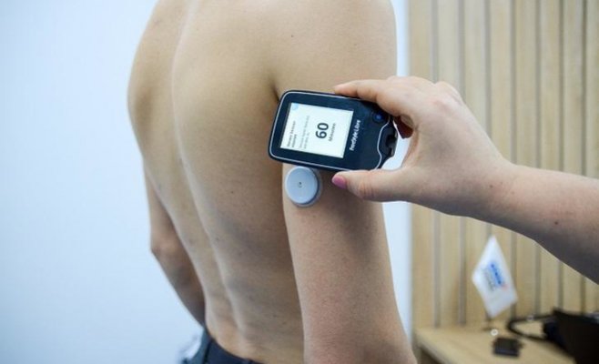 Диабет без уколотых пальцев и с более точными измерениями. До трети больных диабетом I типа уже имеют такие датчики