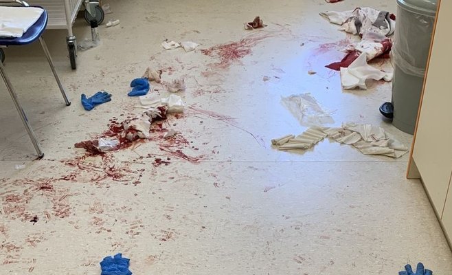 Мужчина с мачете напал на больницу в Чешских Будейовицах, ранив четырех человек