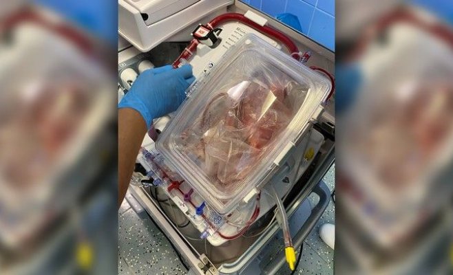 Из Кошиц в Прагу доставлено еще бьющееся сердце