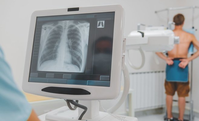 Только треть пришла на скрининг легких