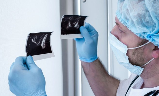 Рак предстательной железы угрожает миллиону чехов