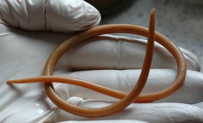 Австралийские врачи удалили живую восьмисантиметровую нематоду из мозга женщины