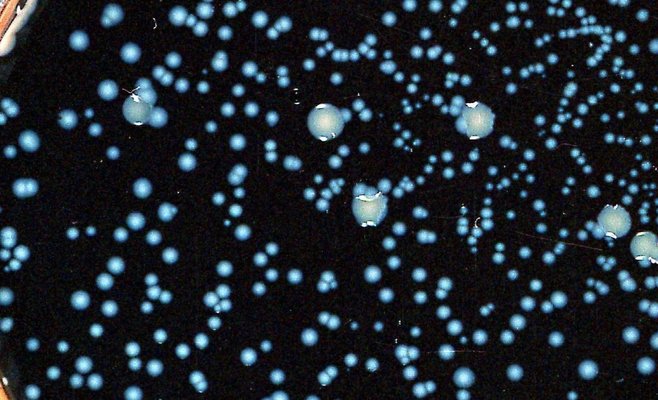 Распространение легионеллеза на другие районы Польши. Число жертв уже достигло 18 человек