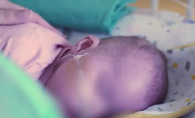 Врачи в Мотоле пересадили сердце трехмесячной девочке