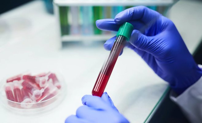 Многие люди даже не подозревают о том, что они подвержены риску сердечной недостаточности