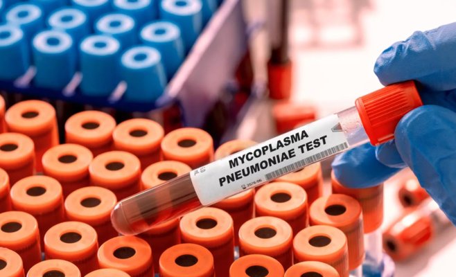 Эксперты: Массовое распространение бактерий микоплазмы из Китая не является неизбежным