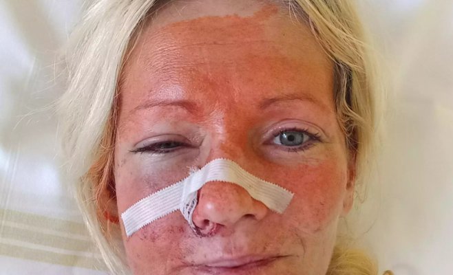 Нападение было мотивировано национальностью жертв, говорится в обвинительном заключении по делу о нападении на украинок