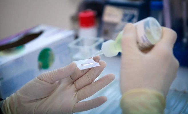 ВОЗ ожидает увеличения числа случаев заболевания раком на 77 % к 2050 году