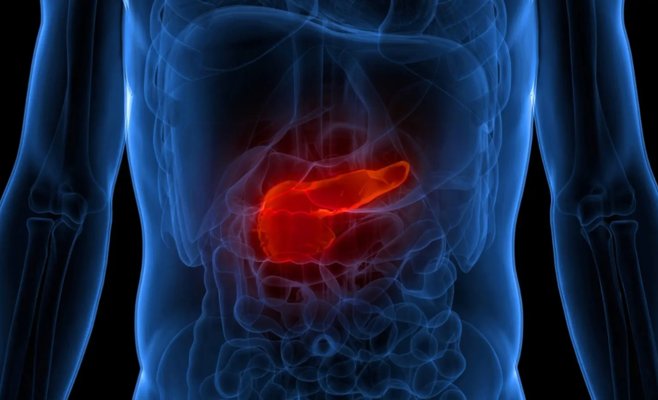 Врачи хотят проверить сотни пациентов из группы риска на рак поджелудочной железы