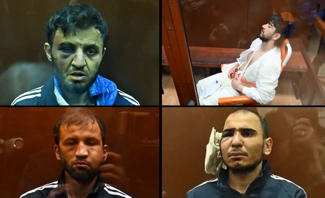 Синяки и отрезанное ухо у задержанных после московского теракта? Кремль не комментирует